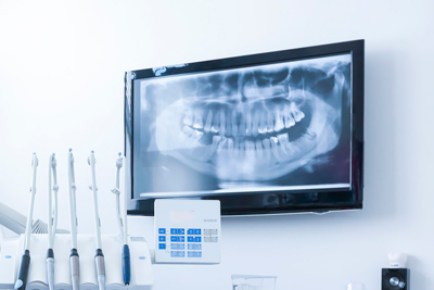 RADIOLOGÍA 3D