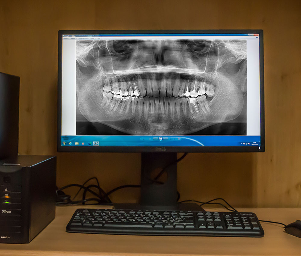 Instalaciones de Clínica dental Polident en Toledo
