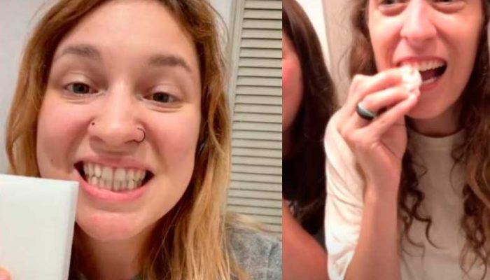 Modas dentales y salud oral