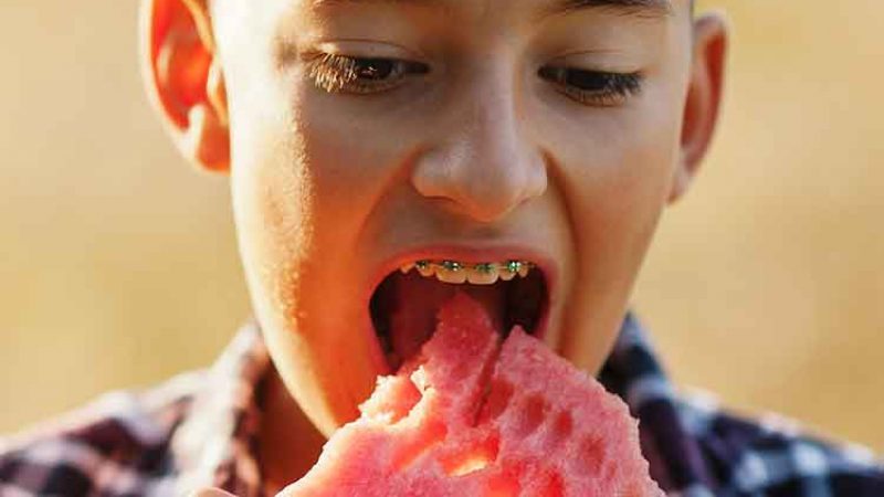 clínica dental en toledo Polident Alimentos a evitar con ortodoncia