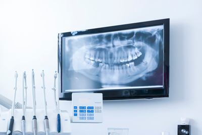 dentistas en polígono toledo clinica dental en poligono toledo Polident