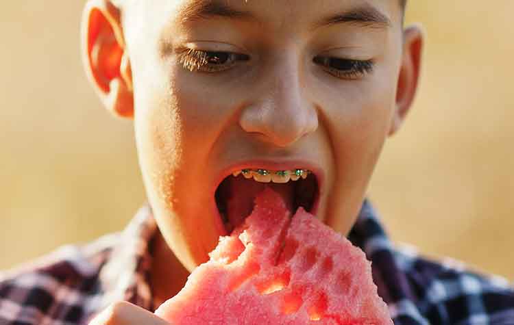 clínica dental en toledo Polident Alimentos a evitar con ortodoncia